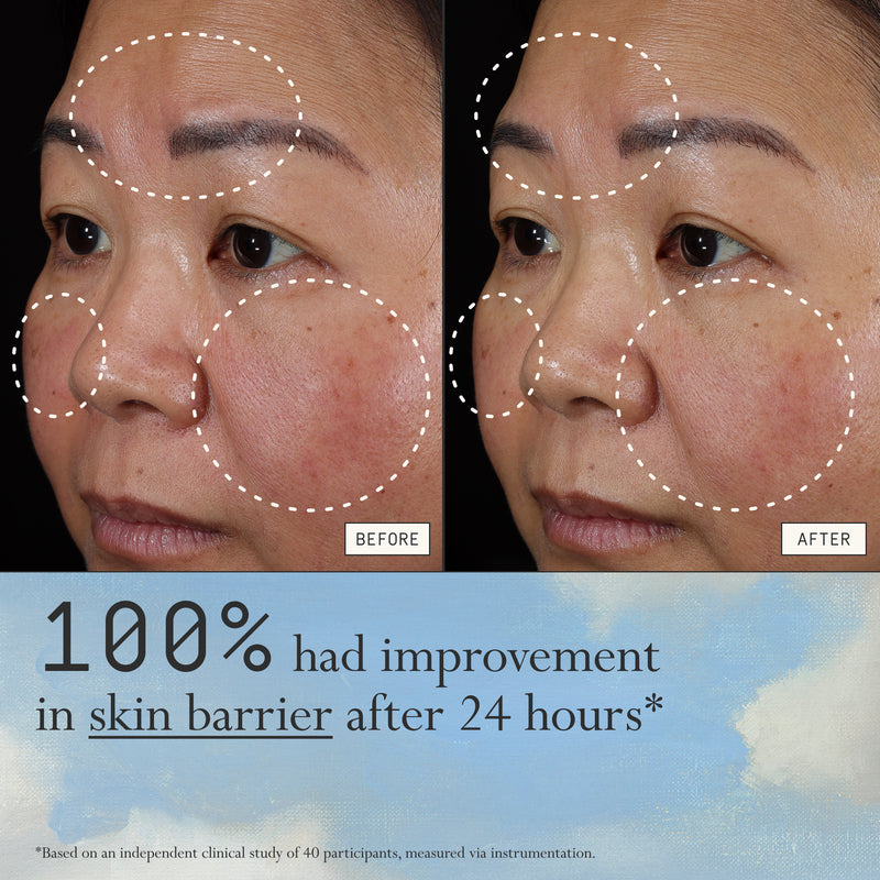 Instant Angel Lipid Rich Firming Moisturizer Hydrating Skin Repair