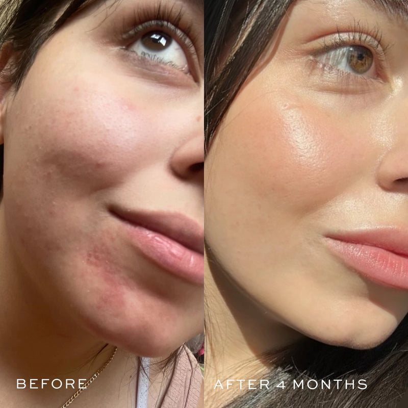 Blue Facial Oil – Hydrating, Brightening & Lightweight Skincare Serum