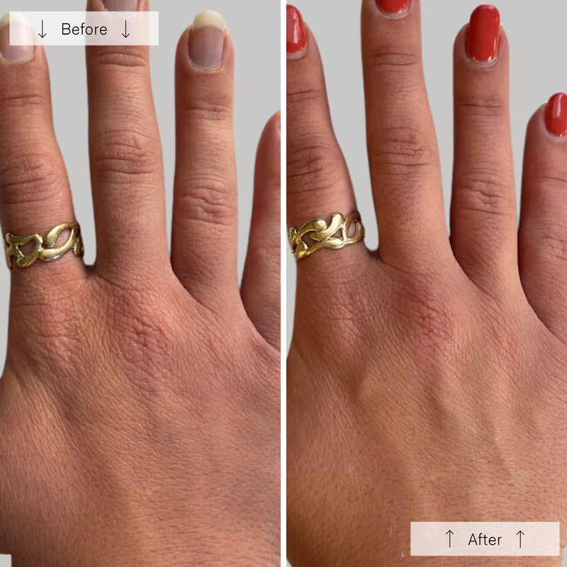 Omnilux Contour Glove LED Light Therapy Hand Rejuvenation Device