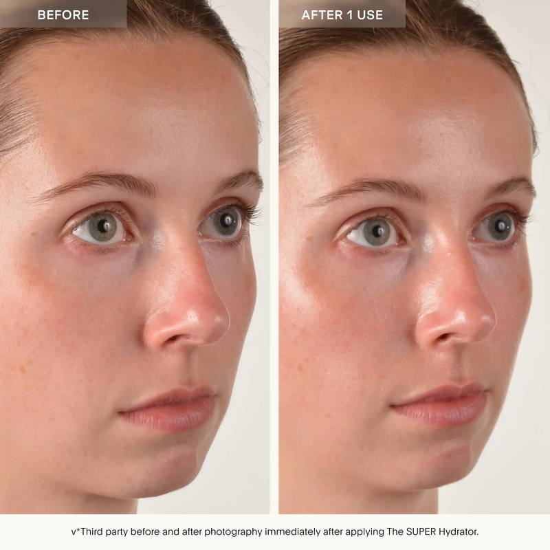 The SUPER Hydrator | Deep Moisture & Nourishing Skin Care