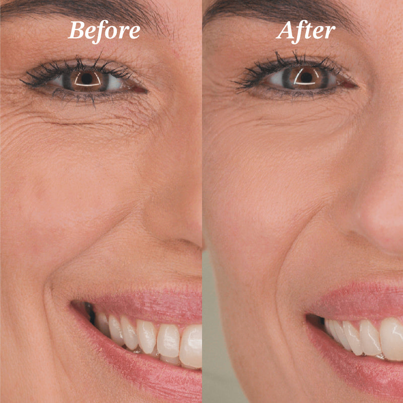 Up the Anti Night Cream – Anti-Aging Overnight Repair Moisturizer